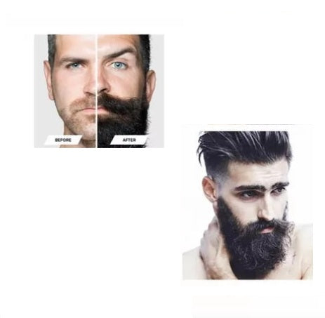 "Sérum Crecimiento de Barba | Aceite Natural para Barba Densa"